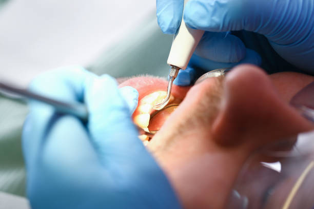 Best Broken or Cracked Tooth Emergency Dentist in Larned, KS